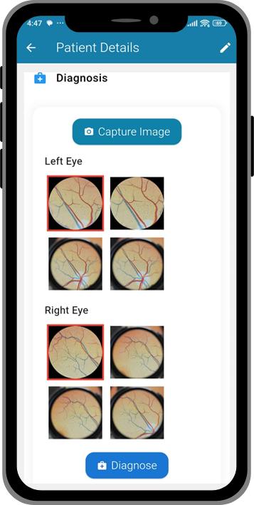 Lunera app screen showing analysis results